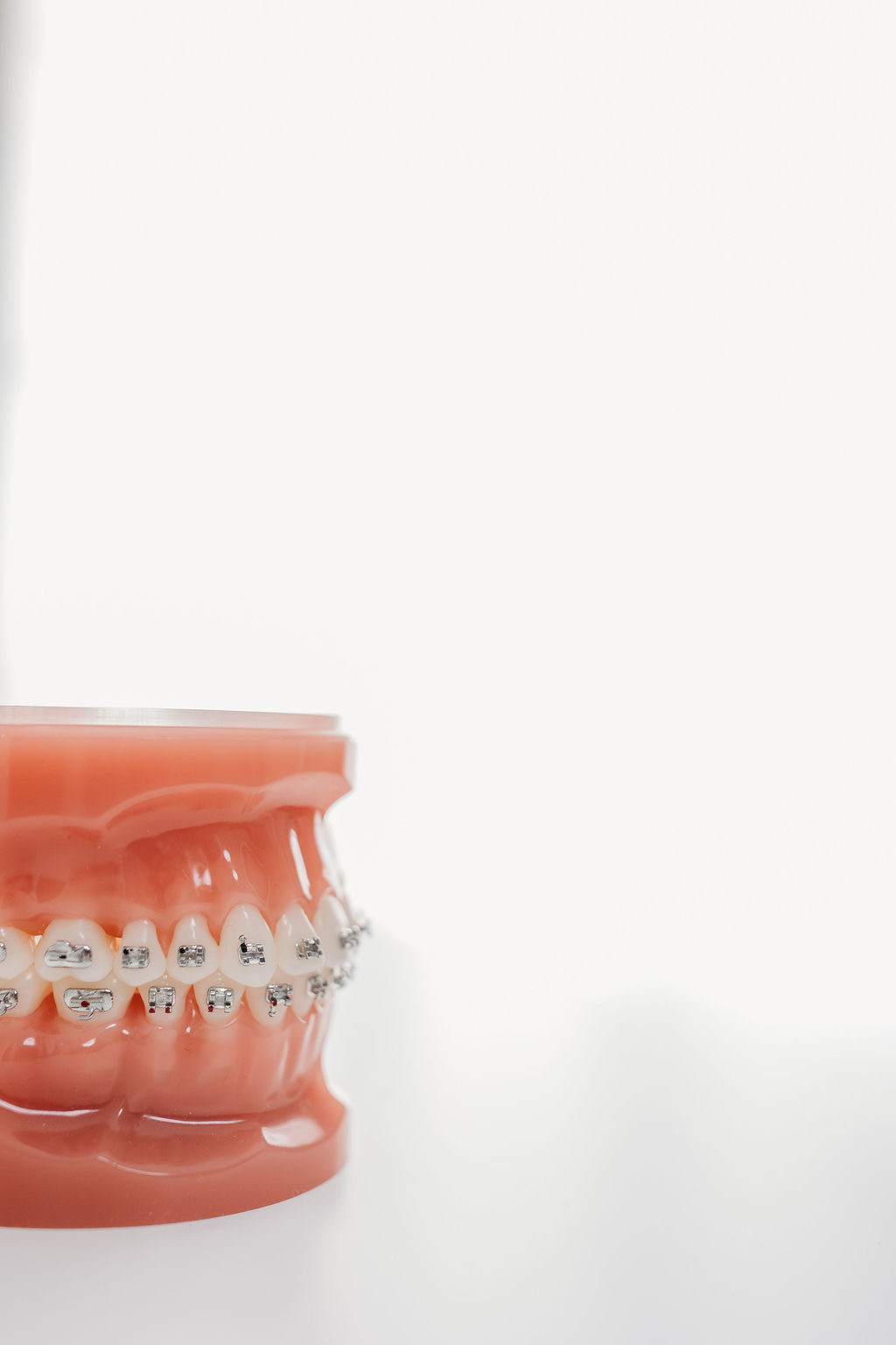 Smiles at Graf Orthodontics